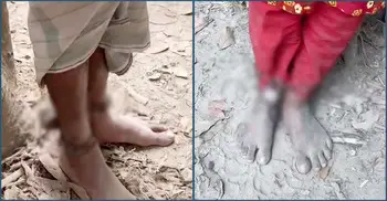 দেখা করতে গিয়ে প্রেমিক-প্রেমিকার হাতে দড়ি, পায়ে শিকল