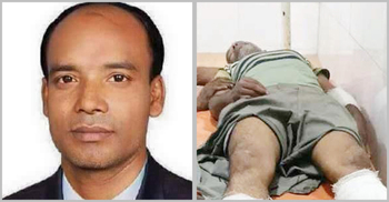 বাজারে যাওয়ার পথে সাবেক চেয়ারম্যানকে হাতুড়িপেটা