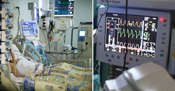 মৃত মানুষকে কী লাইফ সাপোর্টে রাখা সম্ভব?