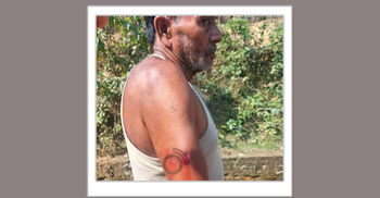 Bangladeshi injured in firing from Myanmar