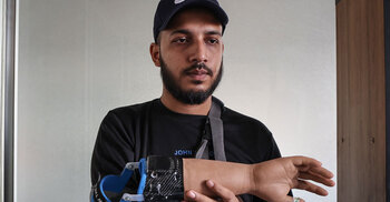 Wounded uprising protesters receive robotic helping hand