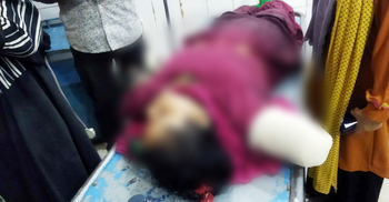 দুই বাসের সংঘর্ষে নারীর হাত বিচ্ছিন্ন