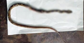 একসঙ্গে দুই ভাই-বোনকে কামড়ালো সাপ