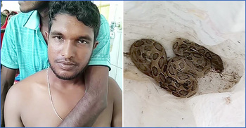 কামড় দেওয়া রাসেল ভাইপার নিয়ে হাসপাতালে যুবক