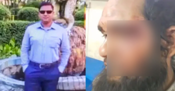 ‘আমি পুলিশ, মারলেও বিচার নাই’ চাচাতো ভাইকে রক্তাক্তের পর এএসআই