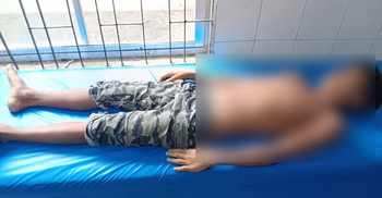 ঘুমন্ত অবস্থায় সাপের কামড়ে কিশোরের মৃত্যু