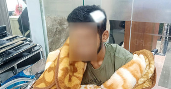 শিক্ষকের ছোড়া ডাস্টারের আঘাতে মাথা ফাটলো শিক্ষার্থীর