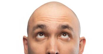 সিরাম কি পারবে ২০ দিনে চুল গজাতে যা বলছেন গবেষকরা