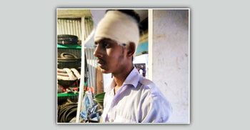 কিশোর গ্যাংয়ের হামলার শিকার হয়ে হাসপাতালে এসএসসি পরীক্ষার্থী