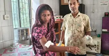 এক কুকুরের কামড়ে আহত অর্ধশতাধিক