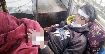 গভীর রাতে ‘চোরের’ কামড়ে বাড়ির মালিকের ছেলে আহত