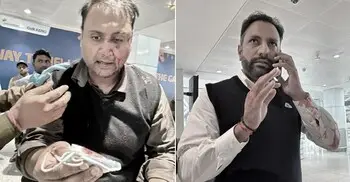 বাচ্চার সামনেই যাত্রীকে মেরে রক্তাক্ত করলেন ভারতীয় পাইলট