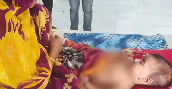 রাজশাহী মেডিকেল কলেজ হাসপাতালে হাম আক্রান্ত শিশুর মৃত্যু