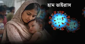 টিকা নিলেও ঝুঁকি? জানুন শিশুদের হামে নতুন বাস্তবতা