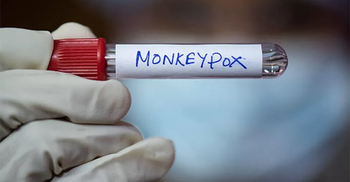 Monkeypox: WHO declares global emergency over