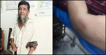 26 hurt in Sunamganj dog bites