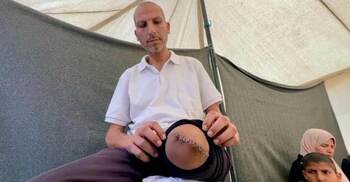 Gazans ‘shackled and blindfolded’ at Israel hospital