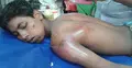 চশমা চুরির অভিযোগে এতিম শিশুকে নির্মম নির্যাতন
