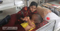 সাতক্ষীরার সেই শিশুটিকে নিউরোসায়েন্স হাসপাতালে ভর্তি করা হলো