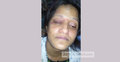 ৫০ লাখ টাকা যৌতুকের দাবিতে গৃহবধূকে খুন্তির ছ্যাঁকা