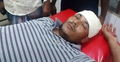 হাতুড়ি দিয়ে কর্মীর মাথা ফাটালেন আ’লীগ নেতা