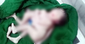 কক্সবাজারে চার পা ও তিন হাতবিশিষ্ট অদ্ভুত শিশুর জন্ম