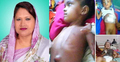 অর্থাভাবে শিশুর চিকিৎসা বন্ধ, পাশে দাঁড়ালেন এমপি স্মৃতি