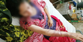 মামলা তুলে নিতে দুই বোনকে মারধর, পুড়িয়ে হত্যাচেষ্টা