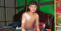 টাকার অভাবে চিকিৎসা বন্ধ গুলিবিদ্ধ আকবর হোসেনের