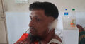 পারিবারিক কলহে স্ত্রীর কামড়ে স্বামীর কান বিচ্ছিন্ন