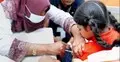 টিকাদানে ঘাটতি জনস্বাস্থ্যে অগ্রগতিকে কীভাবে পিছিয়ে দেয় হাম তার প্রমাণ