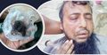 ফেনীতে জামায়াত কর্মীকে পিটিয়ে দাড়ি উপড়ে দিলেন বিএনপি কর্মীরা