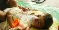 হাম-নিউমোনিয়ায় শিশুমৃত্যু রোধে ‘বাবল সিপ্যাপ’ সম্প্রসারণের উদ্যোগ