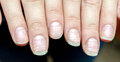নখের সাদা দাগ কীসের ইঙ্গিত দেয়?