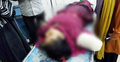 দুই বাসের সংঘর্ষে নারীর হাত বিচ্ছিন্ন