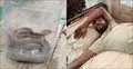 ছোবলের পর জীবন্ত গোখরা সাপ নিয়েই হাসপাতালে যুবক