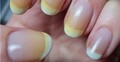 নখের হলদে দাগ দূর করতে যা করবেন