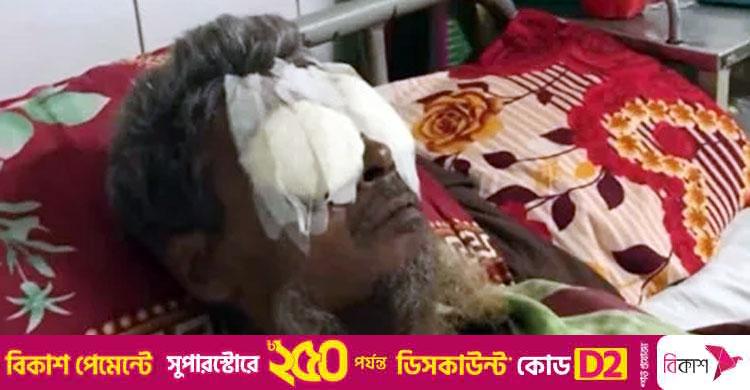 ভাইয়ের কাছে রাখা টাকা-সোনা ফেরত চাওয়ায় চোখ উপড়ে ফেললো দুই ভাই
