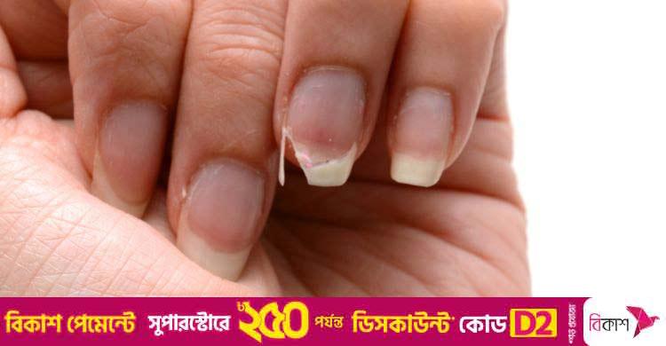 নখ ভেঙে যাচ্ছে? কোন পুষ্টি দরকার, কিসে পাবেন