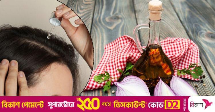 পেঁয়াজের রস কি আসলেই চুল পড়া বন্ধ করে