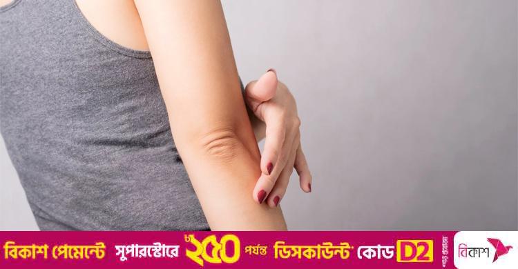 কনুই ও হাঁটুর কালো দাগ কমানোর সহজ উপায়