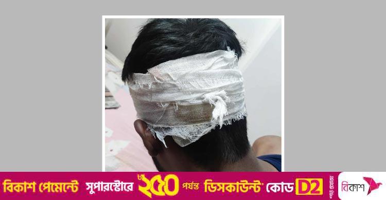 মোটরসাইকেল চালককে থামতে বলায় পুলিশের ওপর হামলা