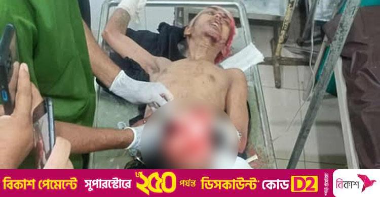 রায়েরবাজারে কিশোর গ্যাংয়ের সংঘর্ষ, যুবকের বাম পা বিচ্ছিন্ন