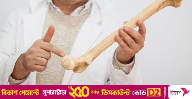 ভিন্ন ভিন্ন বয়সে হাড় মজবুত রাখতে যা খাবেন