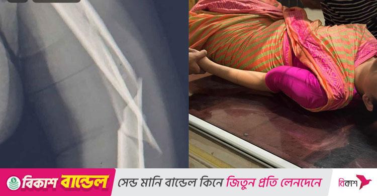 মাঝ আকাশে ঝাঁকুনির কবলে বিমান বাংলাদেশের ফ্লাইট, হাত ভাঙলো ক্রুর