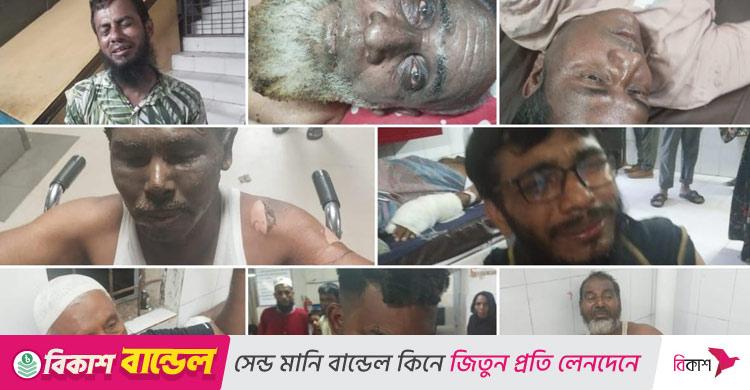 চট্টগ্রামে লোহার ওয়ার্কশপে বিস্ফোরণ, দগ্ধ ৮