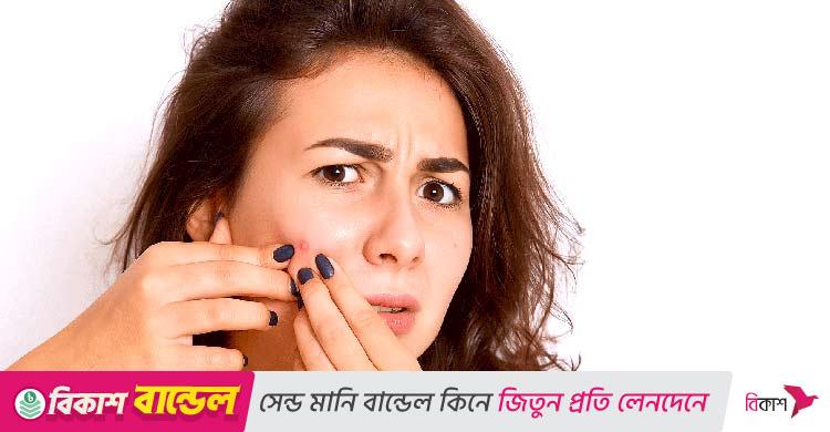মুখের ব্রণ চেপে ফাটালে হতে পারে প্যারালাইসিস