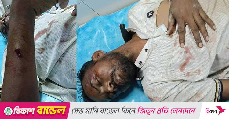 হিরো আলমের ওপর দুর্বৃত্তদের হামলা