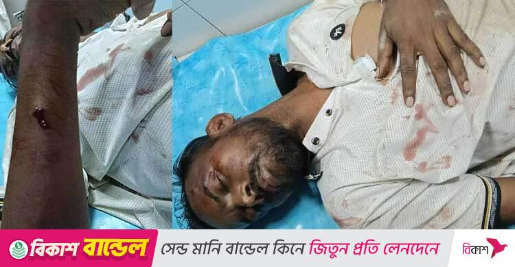 হিরো আলমের অবস্থা ‘আশঙ্কাজনক’, বদলাতে হলো হাসপাতাল