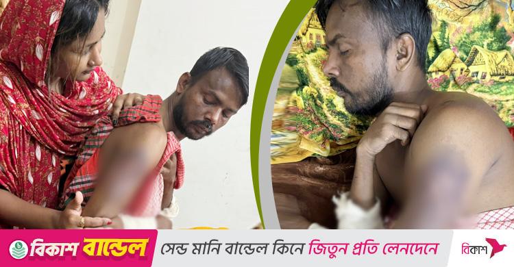 হাসপাতাল থেকে বাড়ি ফিরেছেন হিরো আলম, করবেন মামলা